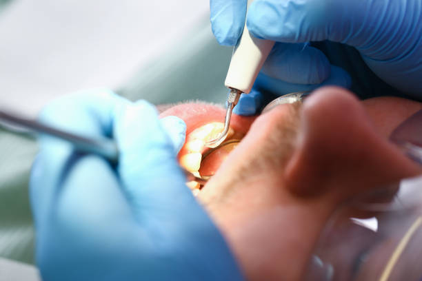 Best Orthodontic Emergency Dentist in Gifford, FL