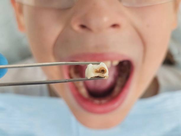 Best Broken or Cracked Tooth Emergency Dentist in Gifford, FL